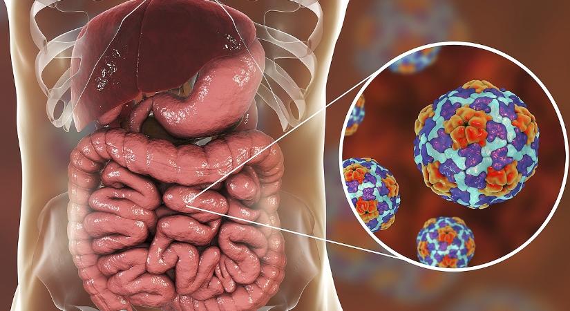 Egyre jobban terjed ez a vírus Magyarországon, már négyen meghaltak