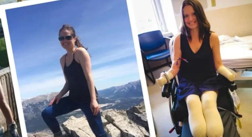 „Bárkivel megtörténhet” - A néma gyilkos miatt veszítette el a végtagjait a fiatal nő