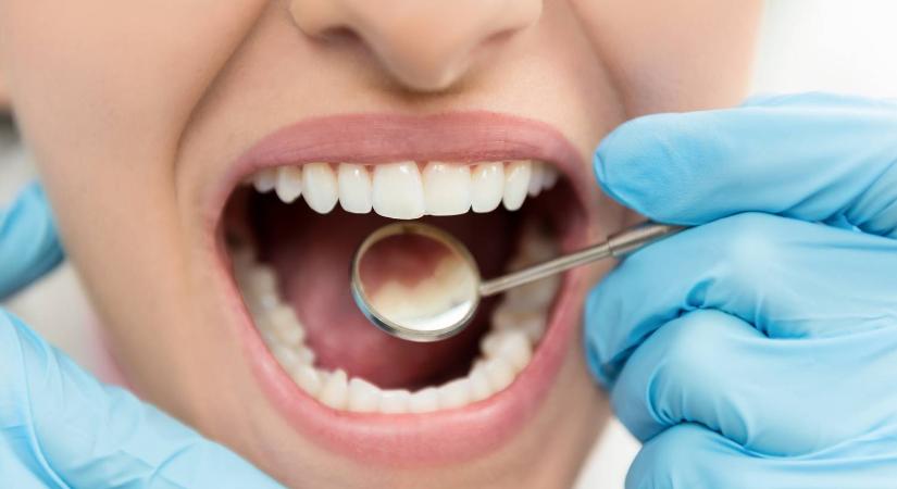 A fogorvos 3 egyszerű tippje: ha ezeket betartja, hibátlanok lesznek a fogai