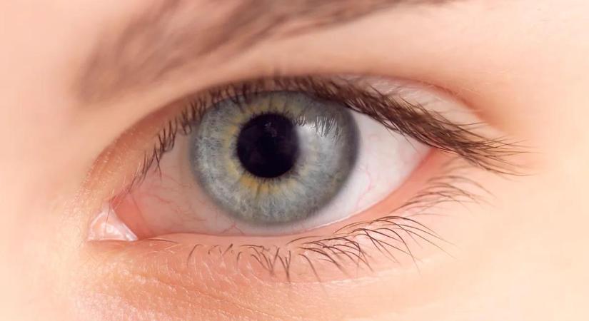 Mit árulnak el a pupilláink? – 8 ok, amiért a szembogár mérete változhat