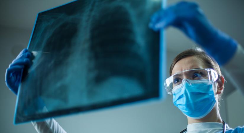 Bogos Krisztina: megfelelő terápiával a tüdőrák már nem számít rettegett betegségnek