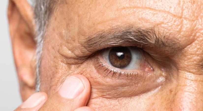 A látást fenyegető betegségek