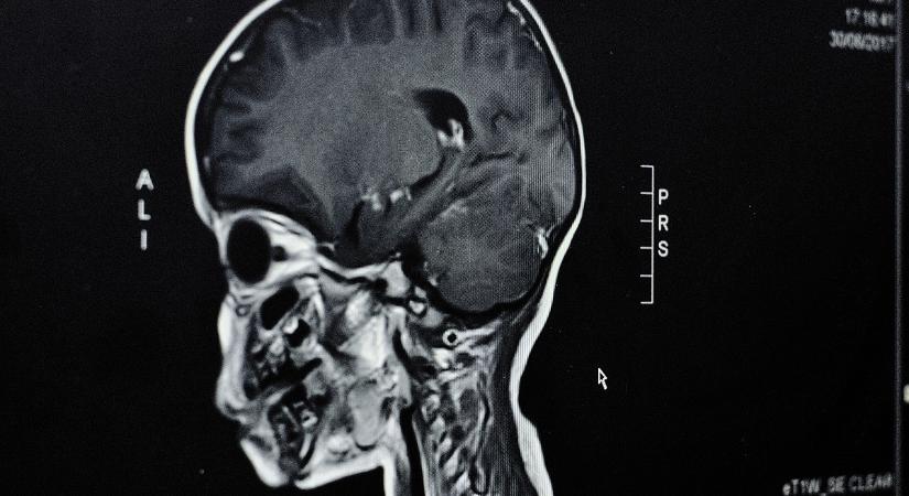 Már a gondolatainkat is célba veszik? Valóra válik a sci-fi rémálom