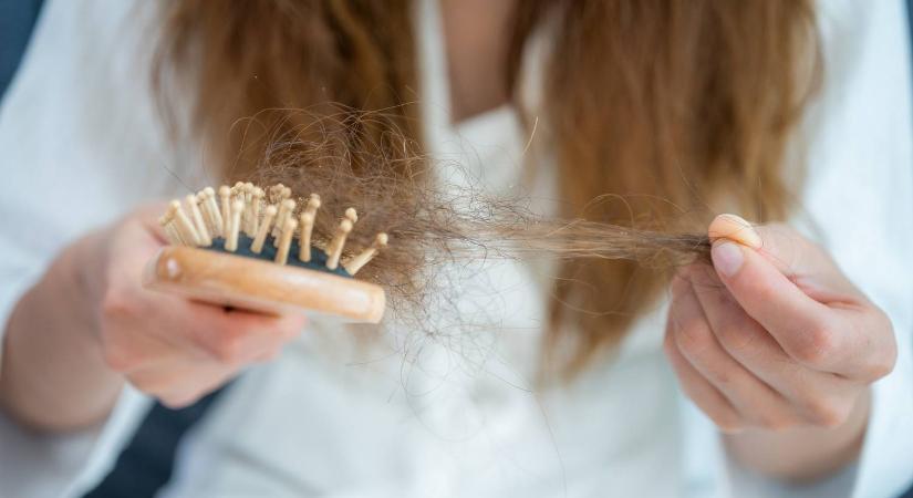 Nem is gondolná: ez az étel sokak kedvence, azonban erős hajhullást okozhat