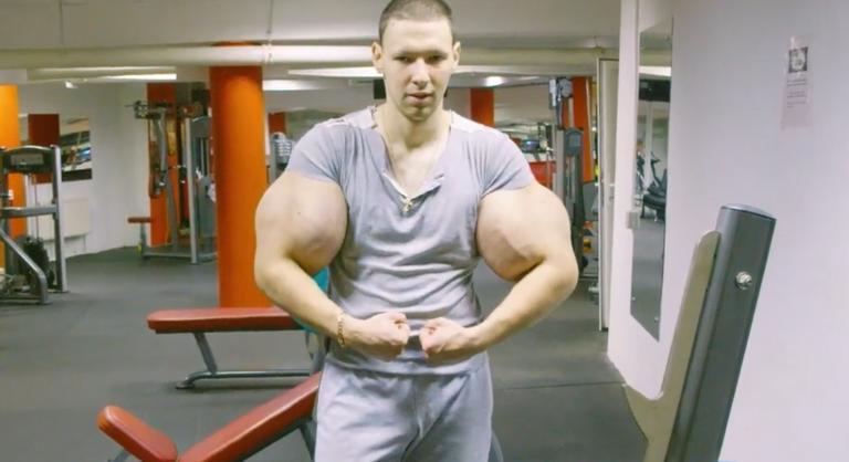 Rengeteg olajat fecskendezett magába, elveszítheti karját az orosz Hulk