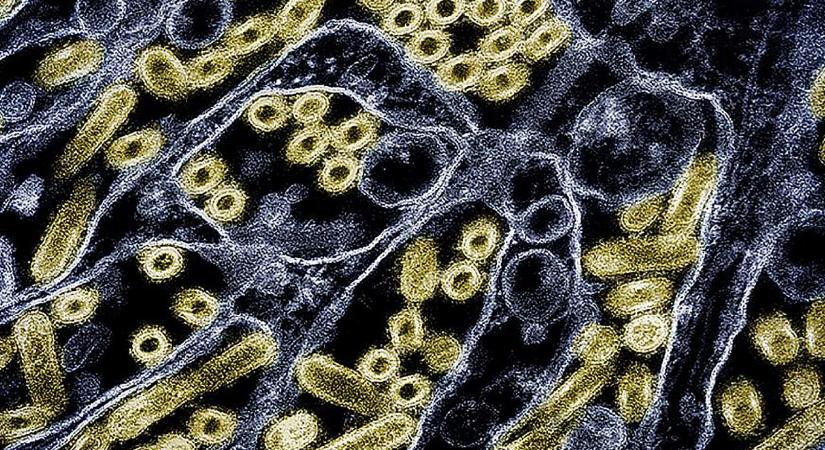 Meghalt az amerikai férfi, akit elsőként fertőzött meg a madárinfluenza H5N5 változata