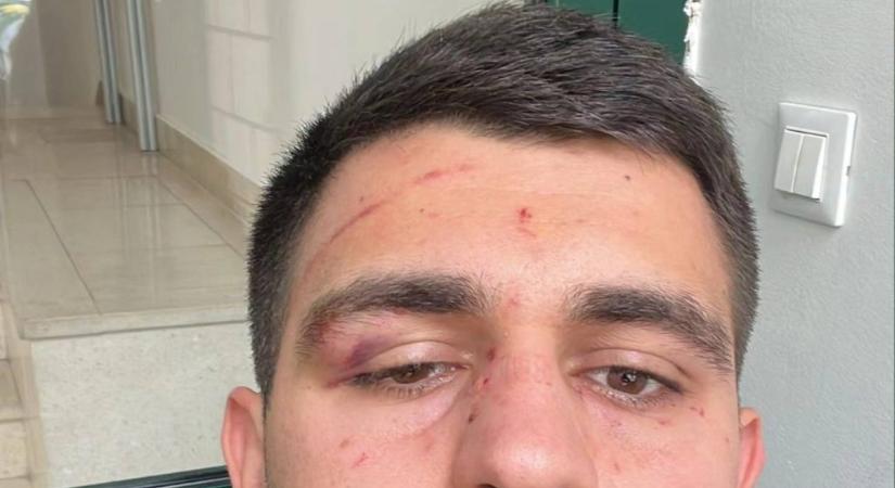 Megharapta a vendégcsapat játékosának a szemét a hazaiak elnöke