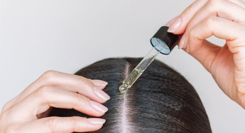 Megtaláltuk a 9 legjobb fejbőrszérumot – bőrgyógyászok ajánlásával