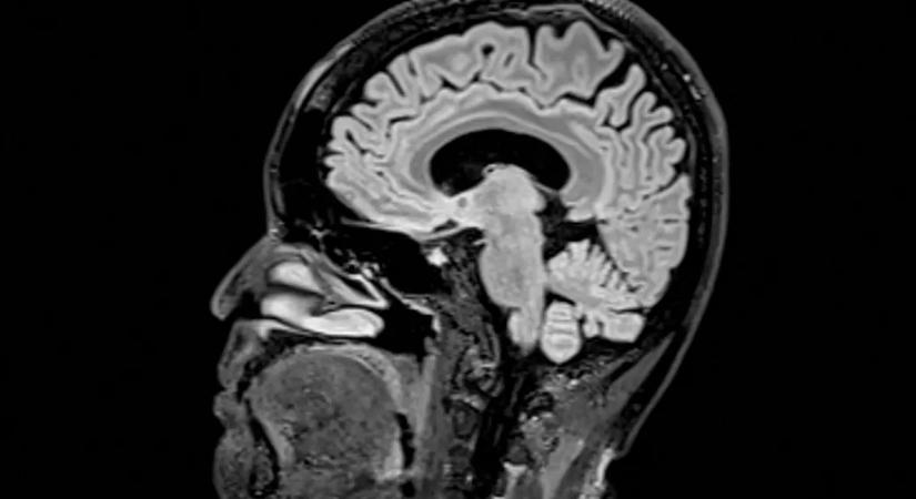 Korszakai vannak az agyunknak, és a felnőttkort 30 év alatt el sem éri