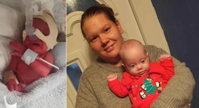 „Először egy fényképen láthattam Lilit” – az anyai ösztön mentette meg a koraszülött gyermeket