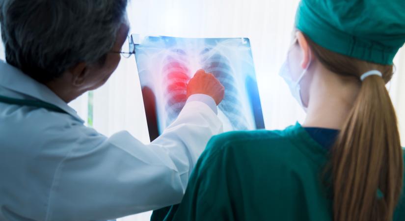 Tüdőrákban 8-9 ezer magyar hal meg évente