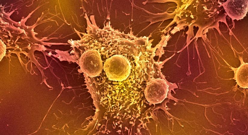 Valami nagyon furcsa történik a rákos sejtekkel