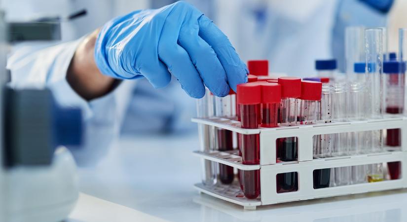 Vérvizsgálat jelezheti előre az 5 éven belüli halálozásunk kockázatát