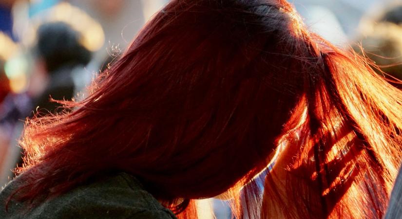 A vörös hajúak sebei lassabban gyógyulnak