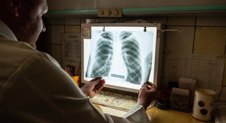 Egy kisvárosnyi ember hal meg évente ebben a kegyetlen betegségben