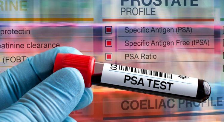 PROSZTATARÁK MEGELŐZÉS – Ingyenes PSA-szűrés a kórházban
