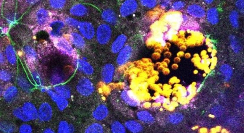 A mikroműanyagok nemcsak önmagukban károsak az emberi szervezetre, hanem kórokozókat is terjeszthetnek