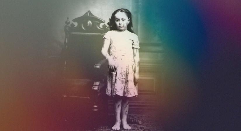 A megkínzott kislány, aki miatt új fejezet kezdődött a gyerekvédelemben – Mary Ellen Wilson története