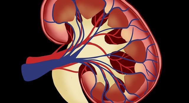 Vesekő-eltávolítás mágneses módszerrel