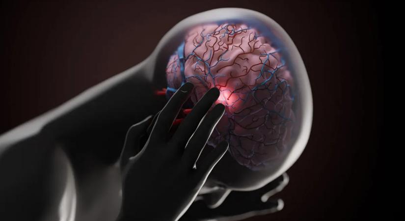 Meglepő ok áll a korai agykárosodás mögött — rengeteg fiatal érintett