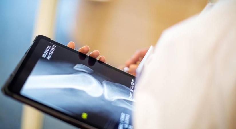 Gyengülnek a csontok és az immunrendszer, ha hiányzik ez a vitamin: ezekre a tünetekre érdemes odafigyelni