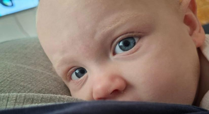 Túl van a műtéten a dégi daganatos kislány