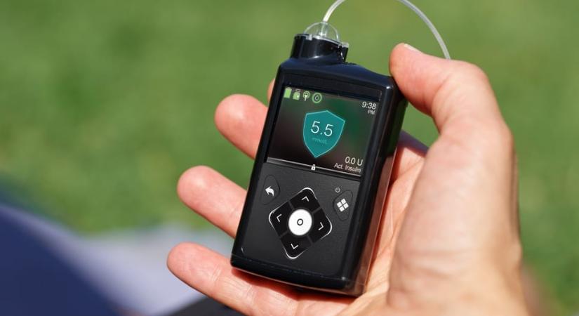 Áttörés jöhet a cukorbetegség kezelésében, ez az új eszköz megkönnyítheti a betegek életét