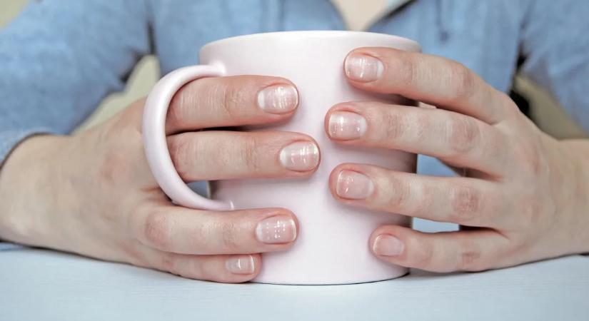 Kalciumhiány: így jelez a tested, hogy baj van – Ne hagyd figyelmen kívül