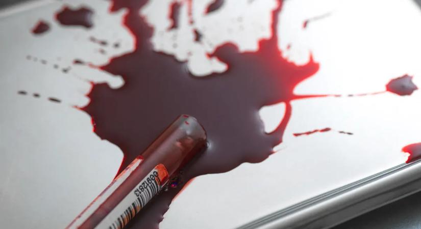 Nagyobb eséllyel lesz rákos, akinek ilyen a vércsoportja