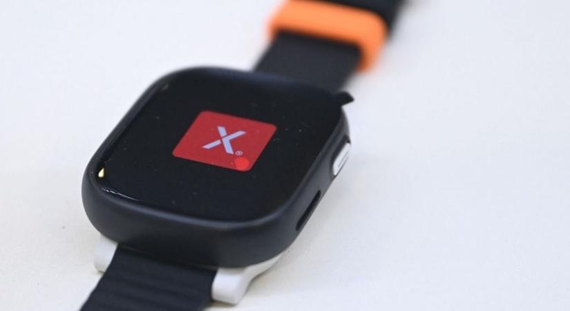 Egy okosóra 88 százalékos pontossággal szúrja ki a szívhibákat!