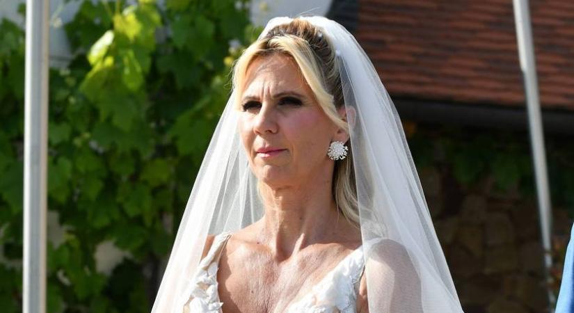 A magyar sztárfeleség arca teljesen más lett a botoxtól: nem így láttuk a tévében