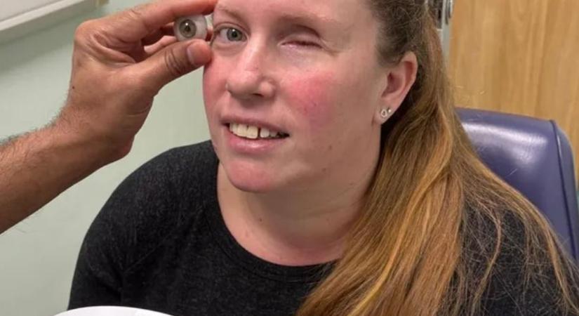 „Azt hittem, valami belement a szemembe – végül elveszítettem az egyik szemgolyómat”