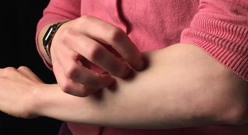 Durván nő az allergia miatti panaszok száma