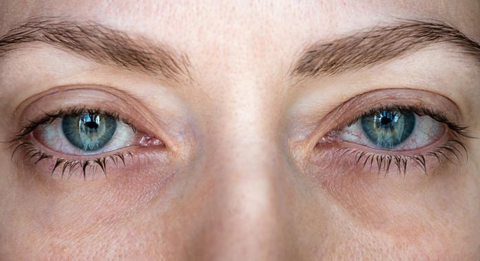 Heerfordt-szindróma