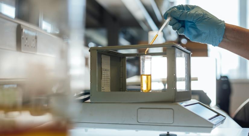 Mi az a leukocita észteráz? – Ezt kell tudnod, ha meglátod a laboreredményedben