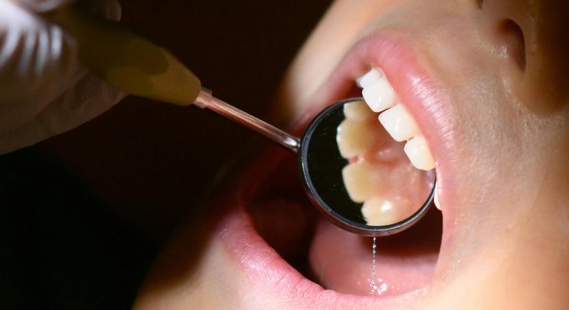 Miért nem mos fogat a gyerek? Nézzük már meg, mit csinál a szülő!