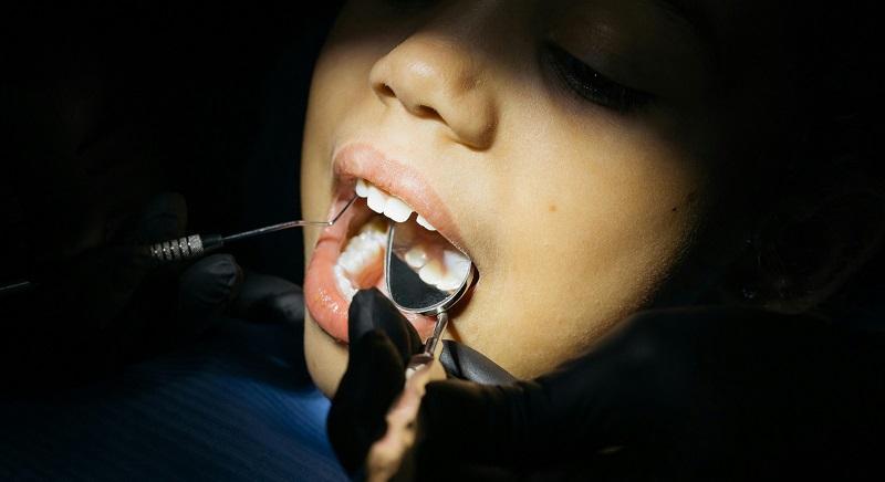 A fogorvos nem mumus! – A félelemmentes fogászat kisgyerekkorban megalapozható