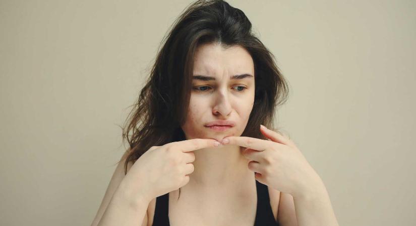 A csodakenőcsöktől a depresszióig – Bőrgyógyászati tanácsadást szerveznek marosvásárhelyi középiskolásoknak