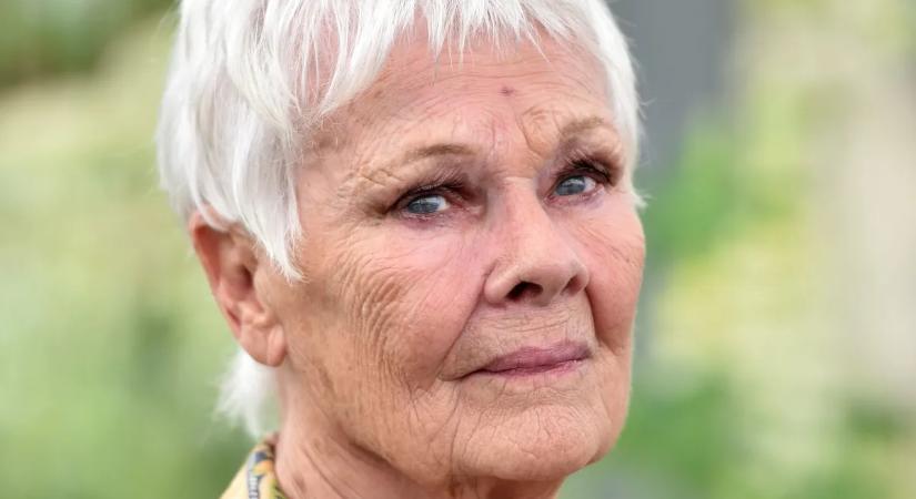 Judi Dench szinte teljesen megvakult, állandó segítségre van szüksége
