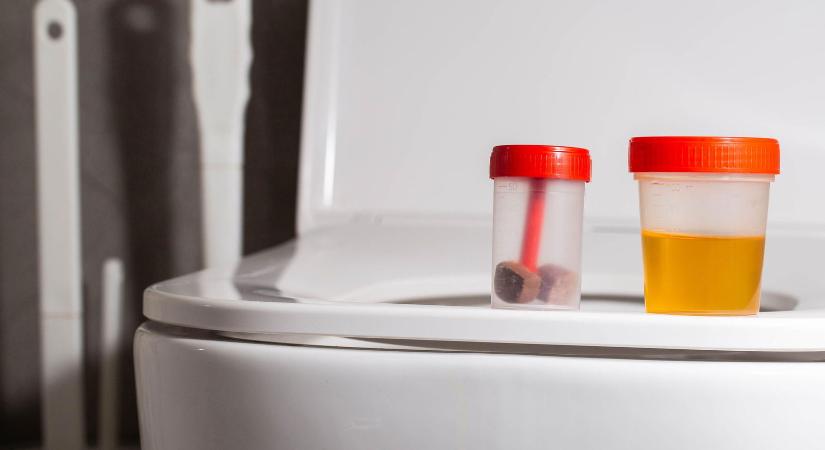 Itt a figyelmeztetés, kiderült az otthoni wc-k szörnyű titka, ezért kell lehajtani mindig a fedelüket használat után