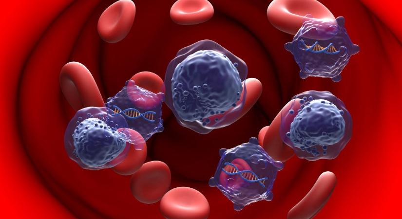 Egy HIV-fertőzött férfi váratlanul meggyógyult őssejt-átültetés után