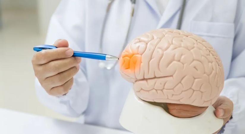 Meglepő kapcsolat: bizonyos ételek valóban védhetnek a stroke ellen