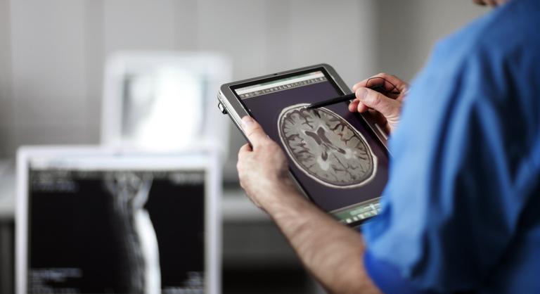 Áttörés jön az Alzheimer-kór kutatásában, egy népszerű fogyókúrás szer segíthet