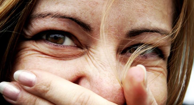 Ha nevet, fáj a feje, mert kiesett az agya a helyéről