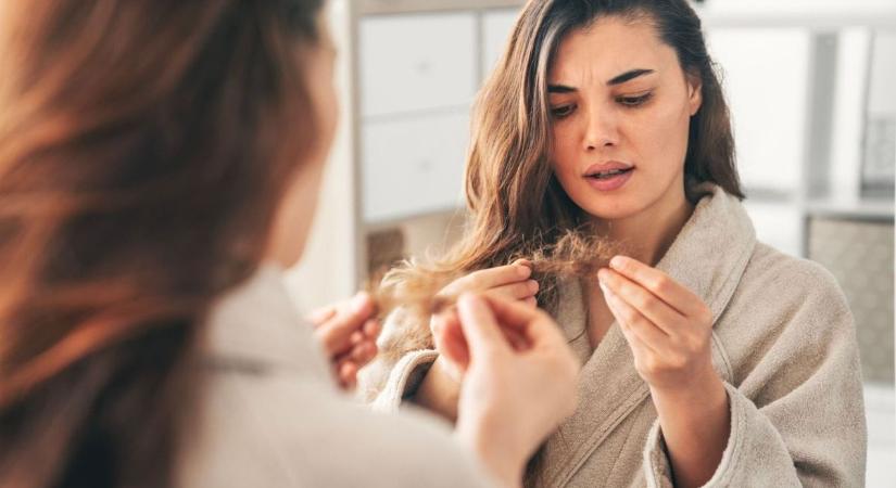 Kopaszodsz és nem tudod mit tegyél ellene? Itt a hajhullás elleni megoldás titka