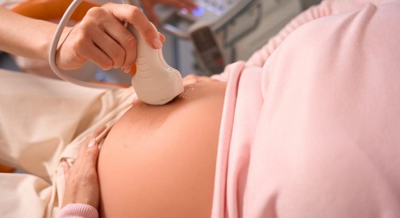 Majdnem elájult a háromgyermekes anya az ultrahangon, amikor meglátta a képet