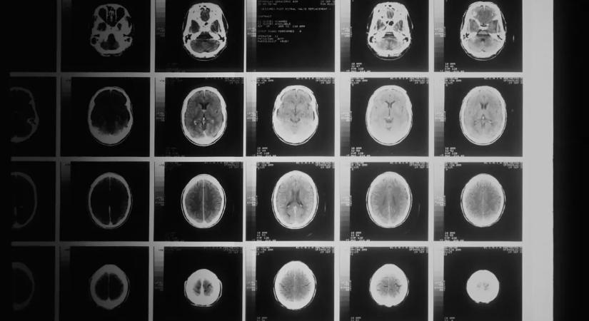 "Fáj a fejem attól, hogy nevetek, mert az agyam kiesik a helyéről"