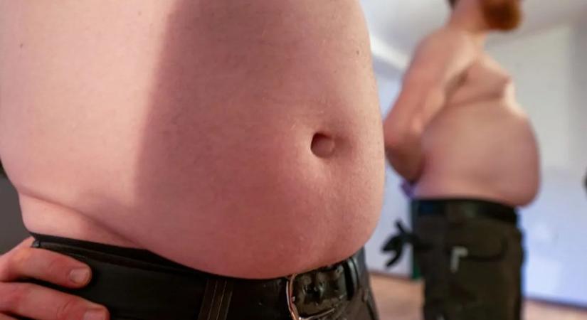 Ezért baj a sörhas: ijesztő eredményt mutat az MRI-vizsgálat