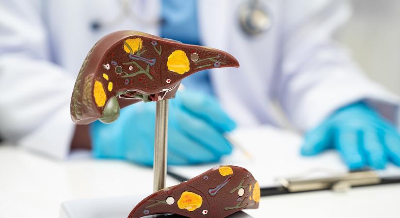 Vigyázz, itt a sárgaság!