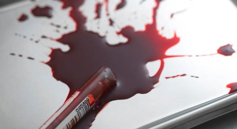 Nagyobb eséllyel lesz rákos, akinek ilyen a vércsoportja